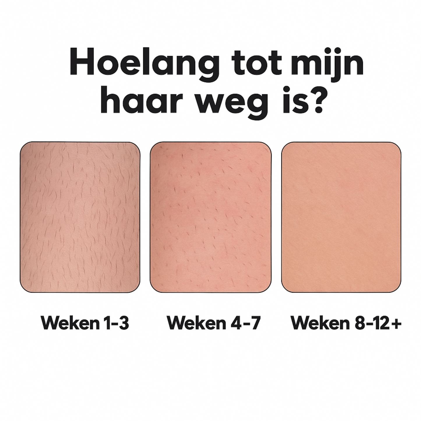 DermaLuxe™ – Pijnloos Ontharingsapparaat
