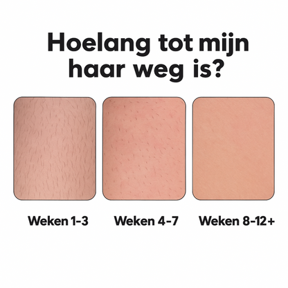 DermaLuxe™ – Pijnloos Ontharingsapparaat